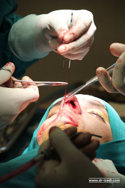 کلینیک جراحی بینی کرج